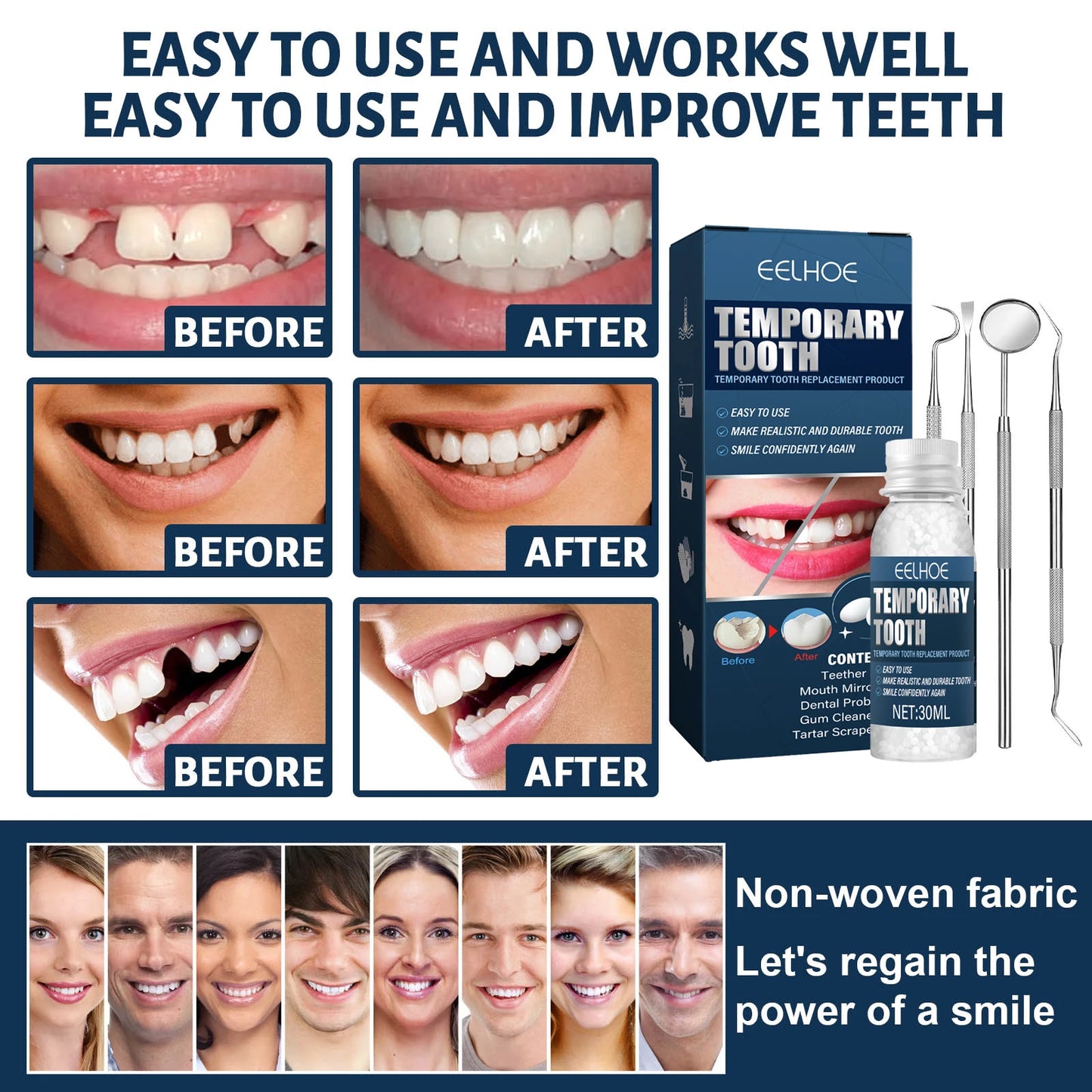 Temporary Tooth Repair Kit – Natural Resin Teeth Replacement Solution